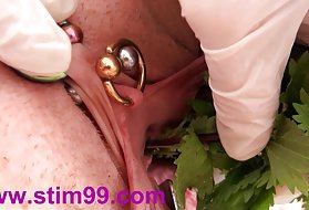 یک مرد به خانم خود زد و همسرش خوابید